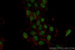 ETV4 Antibody in Immunocytochemistry (ICC/IF)