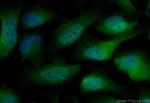 BUB1B Antibody in Immunocytochemistry (ICC/IF)
