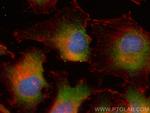 ANXA5 Antibody in Immunocytochemistry (ICC/IF)