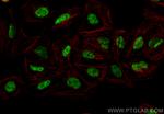 AGXT2L1 Antibody in Immunocytochemistry (ICC/IF)
