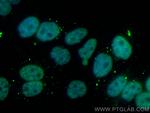 SUMO2/3 Antibody in Immunocytochemistry (ICC/IF)