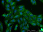 NFKB2,p100 Antibody in Immunocytochemistry (ICC/IF)