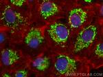 ACSF2 Antibody in Immunocytochemistry (ICC/IF)