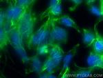 CTNNAL1 Antibody in Immunocytochemistry (ICC/IF)