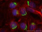 Clusterin Antibody in Immunocytochemistry (ICC/IF)