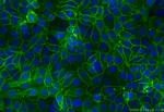 EPCAM/CD326 Antibody in Immunocytochemistry (ICC/IF)