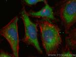 AP2S1 Antibody in Immunocytochemistry (ICC/IF)