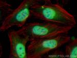 METTL6 Antibody in Immunocytochemistry (ICC/IF)