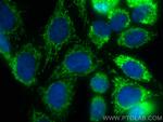 NSUN4 Antibody in Immunocytochemistry (ICC/IF)