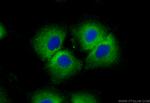 POTEA Antibody in Immunocytochemistry (ICC/IF)