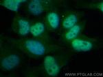 PSMA5 Antibody in Immunocytochemistry (ICC/IF)