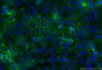 Integrin alpha-5 Antibody in Immunocytochemistry (ICC/IF)