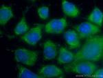 S100A6 Antibody in Immunocytochemistry (ICC/IF)