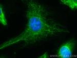 Vimentin Antibody in Immunocytochemistry (ICC/IF)