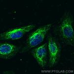 Vimentin Antibody in Immunocytochemistry (ICC/IF)