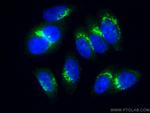 GORASP2 Antibody in Immunocytochemistry (ICC/IF)