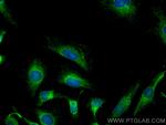 CYB5R3 Antibody in Immunocytochemistry (ICC/IF)