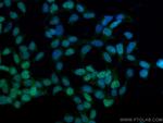 DACH1 Antibody in Immunocytochemistry (ICC/IF)