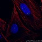 Coilin Antibody in Immunocytochemistry (ICC/IF)