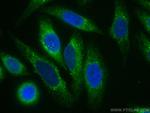 PDI Antibody in Immunocytochemistry (ICC/IF)