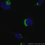 GOLGA2/GM130 Antibody in Immunocytochemistry (ICC/IF)