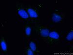 IFT81 Antibody in Immunocytochemistry (ICC/IF)