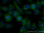 CSPP1 Antibody in Immunocytochemistry (ICC/IF)
