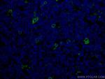 TIMD4 Antibody in Immunohistochemistry (Paraffin) (IHC (P))