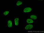 TDP-43 Antibody in Immunocytochemistry (ICC/IF)