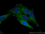 VASP Antibody in Immunocytochemistry (ICC/IF)