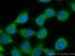 Beta-2-Microglobulin Antibody in Immunocytochemistry (ICC/IF)