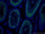 BOULE Antibody in Immunohistochemistry (Paraffin) (IHC (P))