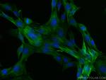 Calponin Antibody in Immunocytochemistry (ICC/IF)