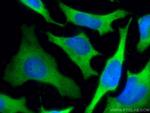 LDHB Antibody in Immunocytochemistry (ICC/IF)