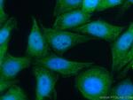RBPMS Antibody in Immunocytochemistry (ICC/IF)