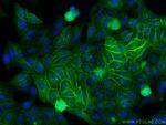 HLA class I ABC Antibody in Immunocytochemistry (ICC/IF)