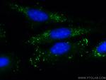 ADRP/Perilipin 2 Antibody in Immunocytochemistry (ICC/IF)