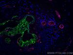 Cytokeratin 7 Antibody in Immunohistochemistry (Paraffin) (IHC (P))