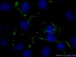 Fibronectin Antibody in Immunocytochemistry (ICC/IF)