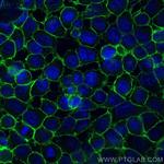 CD44 Antibody in Immunocytochemistry (ICC/IF)