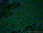 ARG1 Antibody in Immunohistochemistry (Paraffin) (IHC (P))