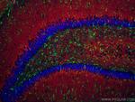 GFAP Antibody in Immunohistochemistry (Paraffin) (IHC (P))