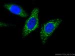 MFF Antibody in Immunocytochemistry (ICC/IF)