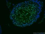 TNP1 Antibody in Immunohistochemistry (Paraffin) (IHC (P))