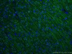 MAP2 Antibody in Immunohistochemistry (Paraffin) (IHC (P))