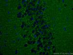 Synaptophysin Antibody in Immunohistochemistry (Paraffin) (IHC (P))