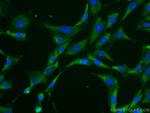 Caspase 3/p17/p19 Antibody in Immunocytochemistry (ICC/IF)