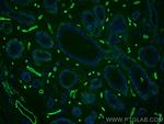 AQP1 Antibody in Immunohistochemistry (Paraffin) (IHC (P))