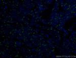 N-cadherin Antibody in Immunohistochemistry (Paraffin) (IHC (P))
