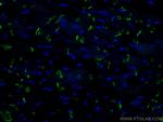 N-cadherin Antibody in Immunohistochemistry (Paraffin) (IHC (P))